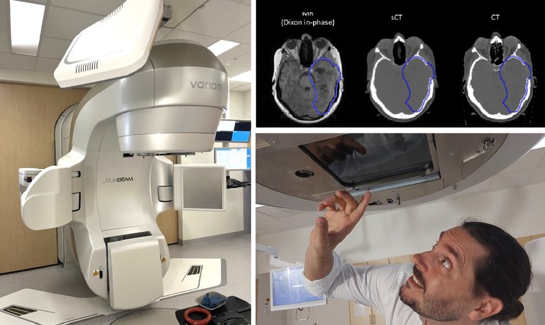 True Beam collage Foto: Varan, Minna Lerner, sjukhusfysiker och Fayme Alm