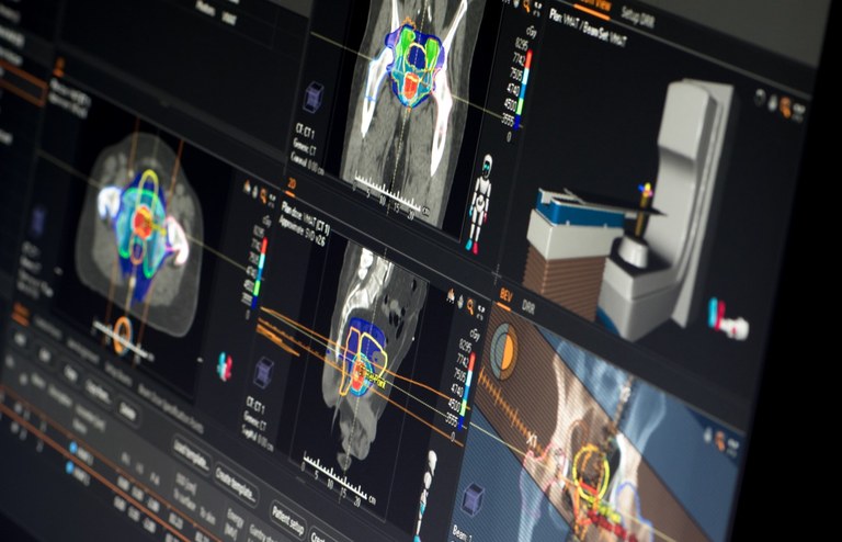 Raysearchbild Foto: Raysearch